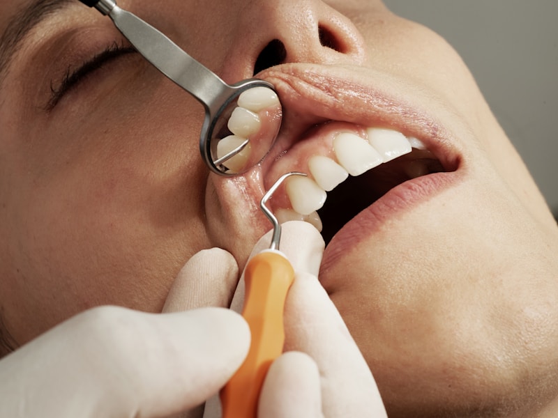 Dental checkup and cleaning at Saraswati Dental Lucknow
