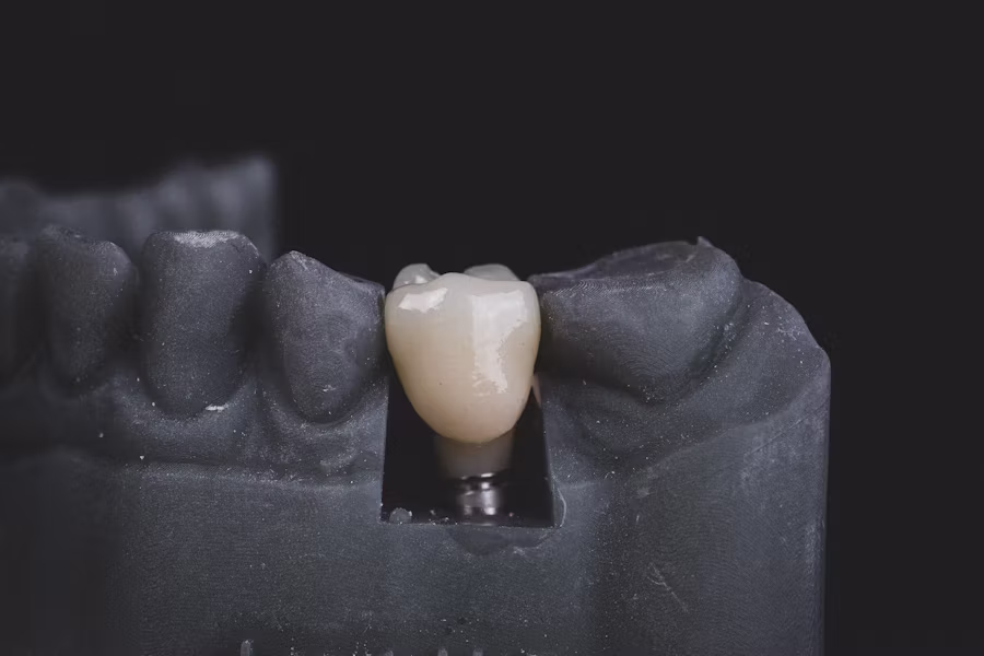 Dental implants in Lucknow by Dr. Devesh Mishra – Saraswati Dental